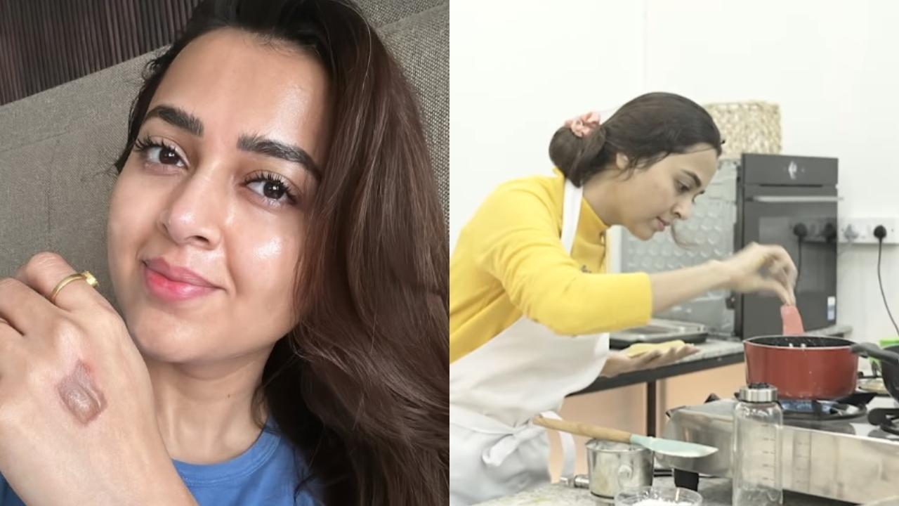 Tejasswi Prakash shows courage writes `show must go on` despite burning herself